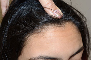 Demostración de la cantidad prevista de reducción