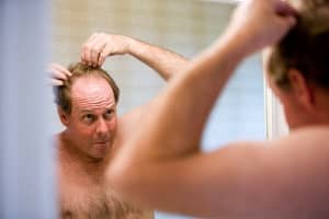 Hair Loss Stats You Need to Know